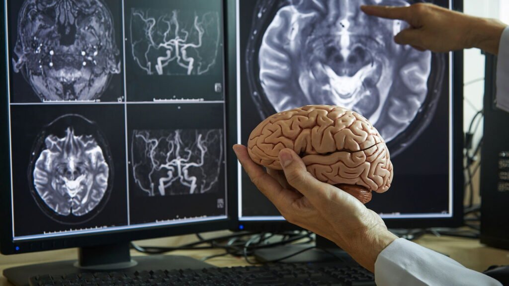Monitor Cerebral